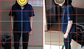 施術終了後の検査・アフターケアのイメージ